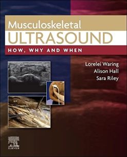 Musculoskeletal Ultrasound: How, Why and When (Original PDF from Publisher)