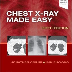 Chest X-Ray Made Easy, 5th edition (True PDF)