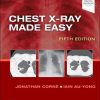 Chest X-Ray Made Easy, 5th edition (Original PDF from Publisher)