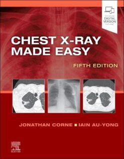 Chest X-Ray Made Easy, 5th edition (Original PDF from Publisher)
