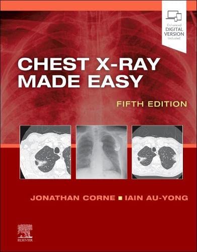 Chest X-Ray Made Easy, 5th edition (Original PDF from Publisher)
