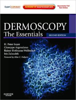 Dermoscopy: The Essentials, 2nd Edition