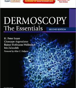 Dermoscopy: The Essentials, 2nd Edition