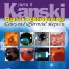 Signs in Ophthalmology: Causes and Differential Diagnosis (Kanski)