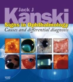Signs in Ophthalmology: Causes and Differential Diagnosis (Kanski)