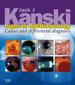 Signs in Ophthalmology: Causes and Differential Diagnosis (Kanski)