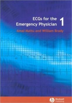 ECG’s for the Emergency Physician 1