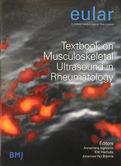 Eular Textbook on Musculoskeletal Ultrasound in Rheumatology (PDF) + EULAR On-line Introductory Ultrasound (Videos + Pictures)