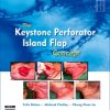 The Keystone Perforator Island Flap Concept (True PDF)
