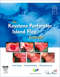The Keystone Perforator Island Flap Concept (True PDF)