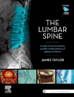 The Lumbar Spine: An Atlas of Normal Anatomy and the Morbid Anatomy of Ageing and Injury (Original PDF from Publisher)