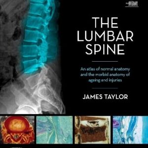 The Lumbar Spine: An Atlas of Normal Anatomy and the Morbid Anatomy of Ageing and Injury (Original PDF from Publisher)