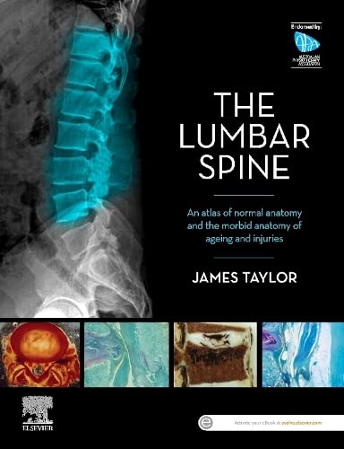 The Lumbar Spine: An Atlas of Normal Anatomy and the Morbid Anatomy of Ageing and Injury (Original PDF from Publisher)