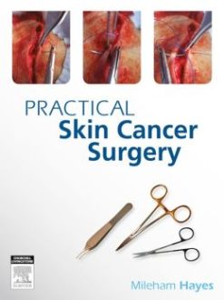 PRACTICAL SKIN CANCER SURGERY