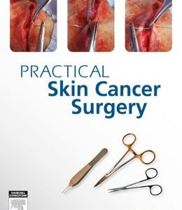 PRACTICAL SKIN CANCER SURGERY