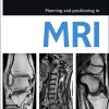 Planning and Positioning in MRI (Original PDF from Publisher)