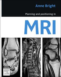 Planning and Positioning in MRI (Original PDF from Publisher)