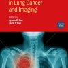 Detection Systems in Lung Cancer and Imaging, Volume 2 (IOP ebooks) (Original PDF from Publisher)