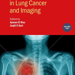 Detection Systems in Lung Cancer and Imaging, Volume 2 (IOP ebooks) (Original PDF from Publisher)