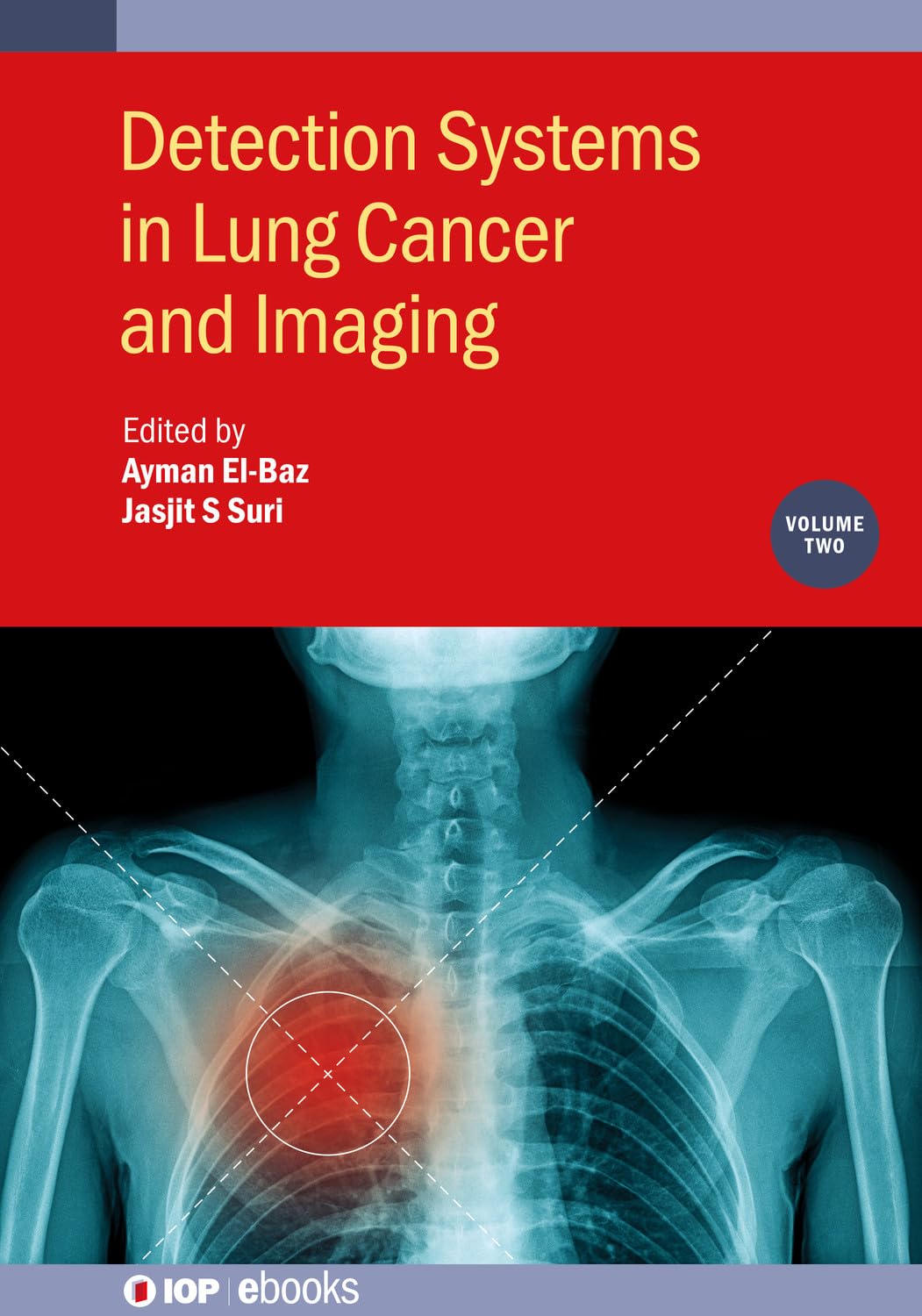 Detection Systems in Lung Cancer and Imaging, Volume 2 (IOP ebooks) (Original PDF from Publisher)
