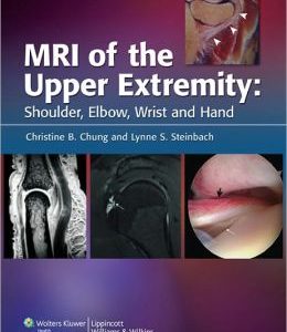 MRI of the Upper Extremity: Shoulder, Elbow, Wrist and Hand (ORIGINAL PDF from Publisher)