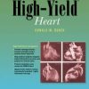 High-Yield Heart (EPUB)