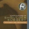 Complications of Shoulder Surgery: Treatment and Prevention (Original PDF from Publisher)