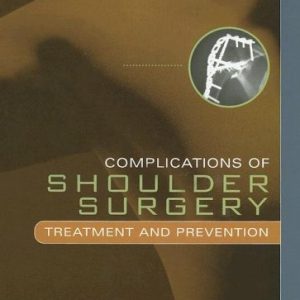 Complications of Shoulder Surgery: Treatment and Prevention (Original PDF from Publisher)