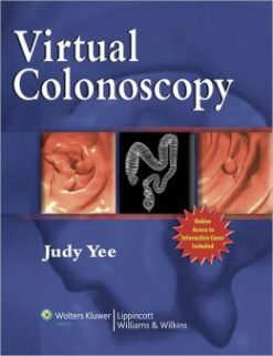 Virtual Colonoscopy