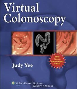 Virtual Colonoscopy