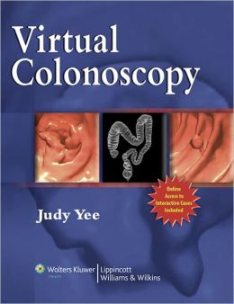 Virtual Colonoscopy