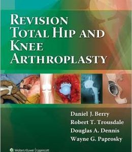 Revision Total Hip and Knee Arthroplasty (ORIGINAL PDF from Publisher)