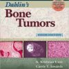 Dahlin’s Bone Tumors: General Aspects and Data on 10,165 Cases, 6th Edition (Original PDF from Publisher)