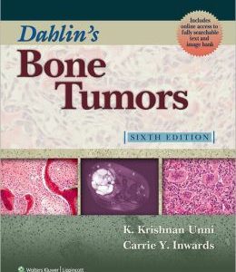 Dahlin’s Bone Tumors: General Aspects and Data on 10,165 Cases, 6th Edition (Original PDF from Publisher)