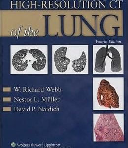 High-Resolution CT of the Lung, 4th Edition (ORIGINAL PDF from Publisher)