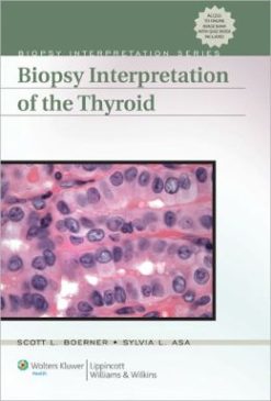 Biopsy Interpretation of the Thyroid (ORIGINAL PDF from Publisher)
