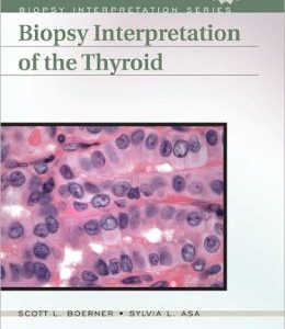 Biopsy Interpretation of the Thyroid (ORIGINAL PDF from Publisher)