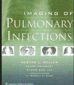 Imaging of Pulmonary Infections (ORIGINAL PDF from Publisher)