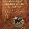 Burkhart’s View of the Shoulder: A Cowboy’s Guide to Advanced Shoulder Arthroscopy (Original PDF from Publisher)