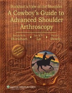Burkhart’s View of the Shoulder: A Cowboy’s Guide to Advanced Shoulder Arthroscopy (Original PDF from Publisher)