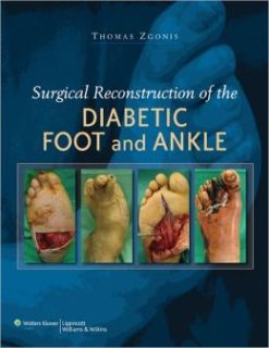 Surgical Reconstruction of the Diabetic Foot and Ankle (Original PDF from Publisher)
