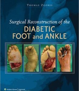 Surgical Reconstruction of the Diabetic Foot and Ankle (Original PDF from Publisher)