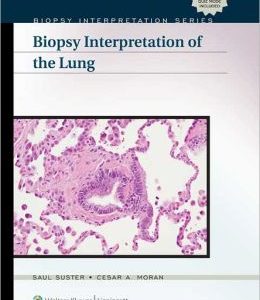 Biopsy Interpretation of the Lung (ORIGINAL PDF from Publisher)