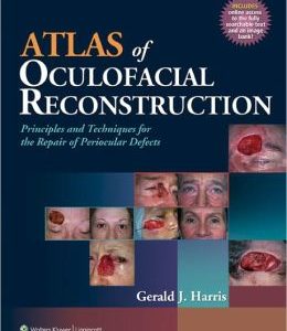 Atlas of Oculofacial Reconstruction: Principles and Techniques for the Repair of Periocular Defects (ORIGINAL PDF from Publisher)