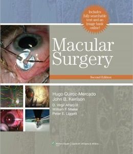 Macular Surgery, 2nd Edition (ORIGINAL PDF from Publisher)