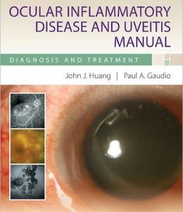 Ocular Inflammatory Disease and Uveitis Manual: Diagnosis and Treatment (Original PDF from Publisher)