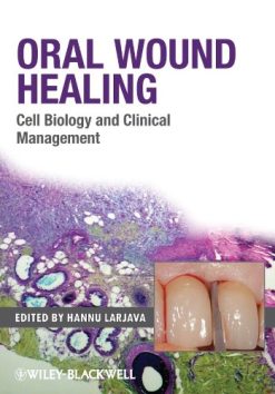Oral Wound Healing: Cell Biology and Clinical Management (Original PDF from Publisher)