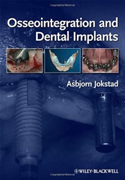 Osseointegration and Dental Implants (Original PDF from Publisher)