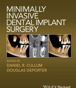 Minimally Invasive Dental Implant Surgery