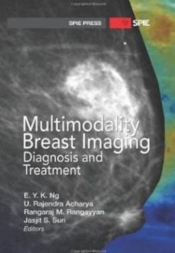 Multimodality Breast Imaging: Diagnosis and Treatment